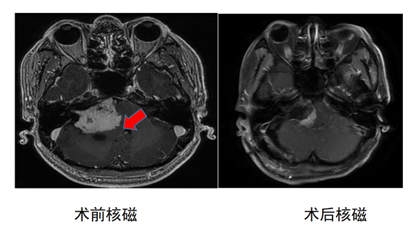 经外二