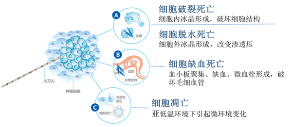 消融刀6