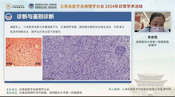 病理2